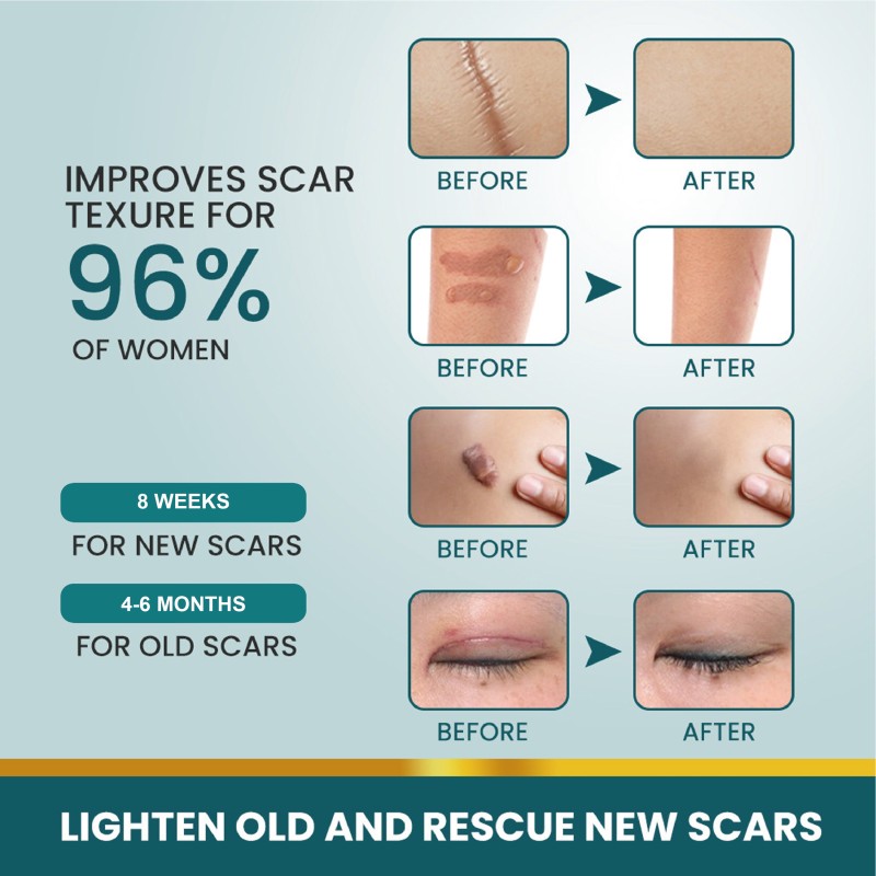 Scar Healing Patches Supplier - Moist Environment Faster Healing