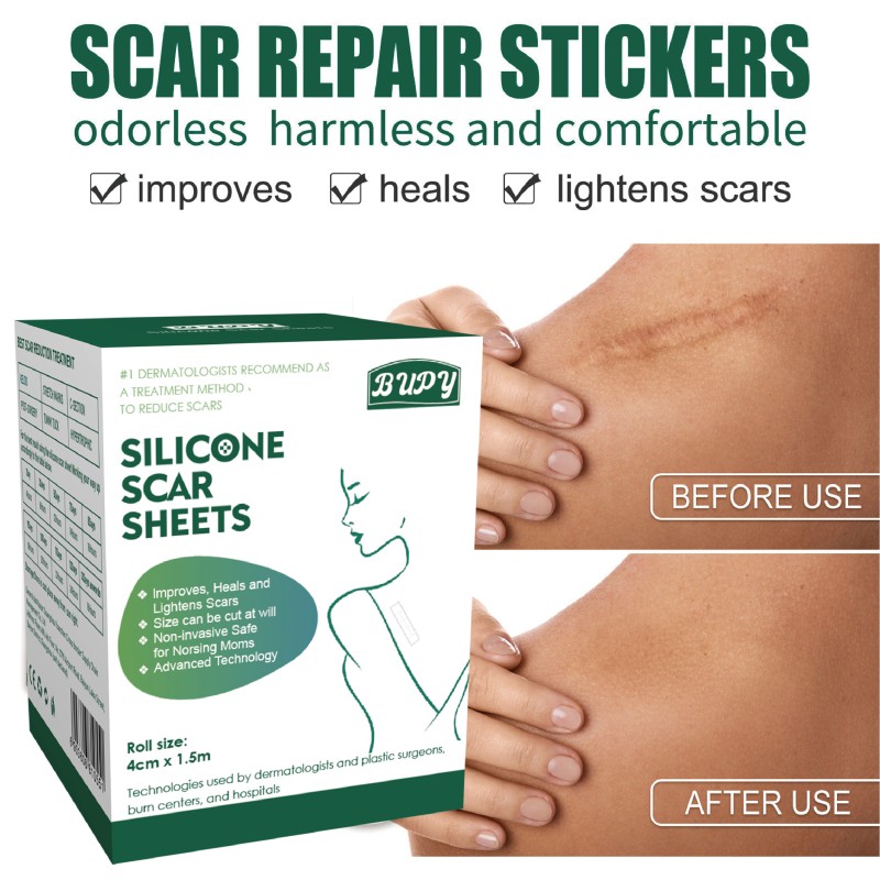 C Section Scar Patch Manufacturer - Soft Silicone Postpartum Recovery