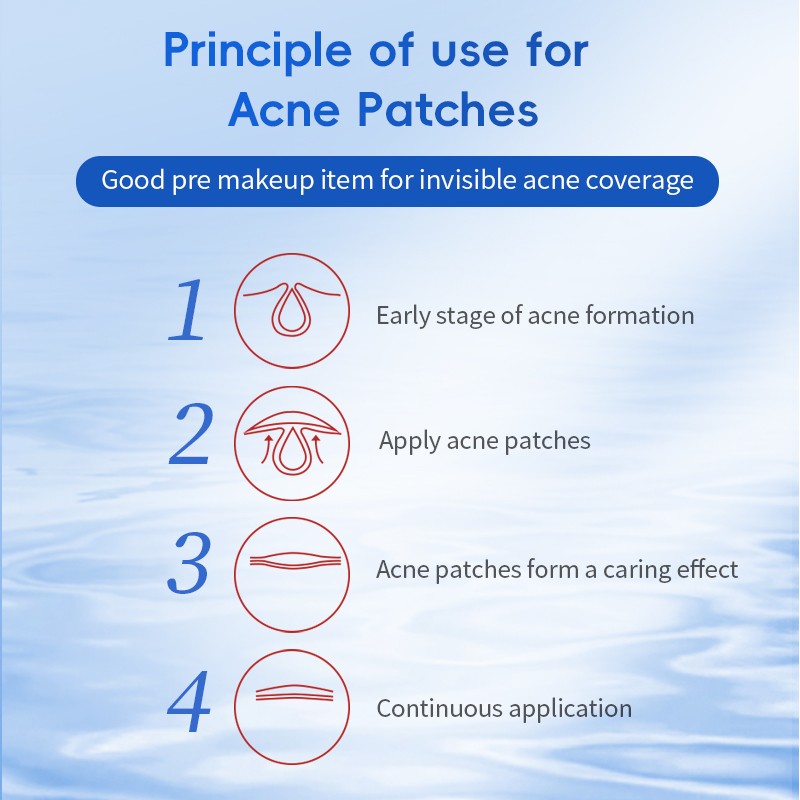 Acne Patches for Face Manufacturer - Extra Adhesion Natural Plant Ingredients