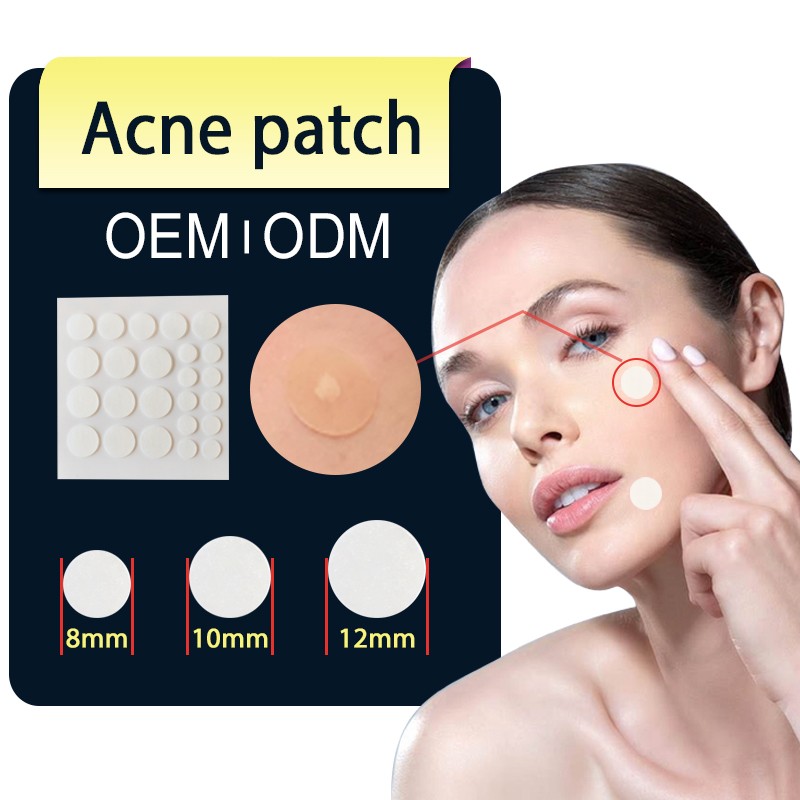 Skin Care Pimple Patches Factory - Customizable Star Shape Hydrocolloid Covering