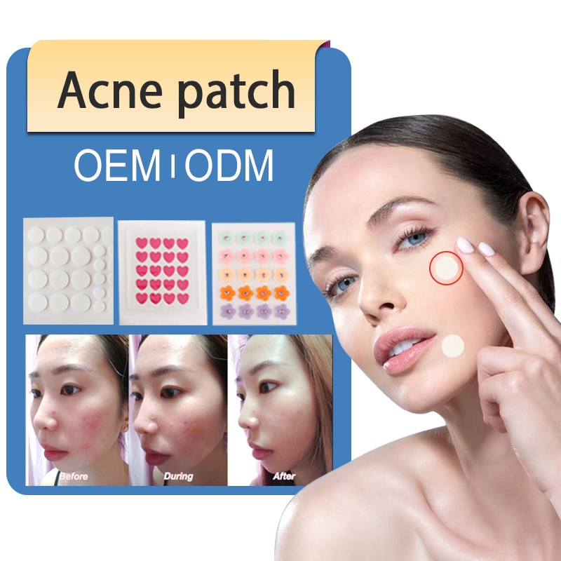 Acne Pimple Patch Supplier - High Quality Colorful Star Patches Effective Removal