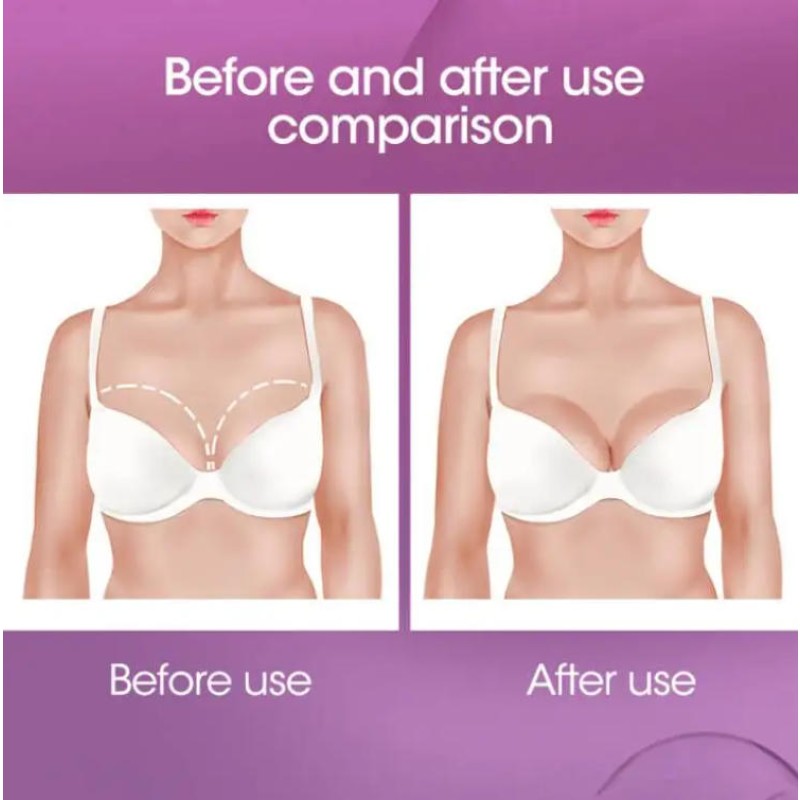 Breast Enlargement Patch Supplier - 2025 Top Selling OEM ODM Nature Herbs Healthcare