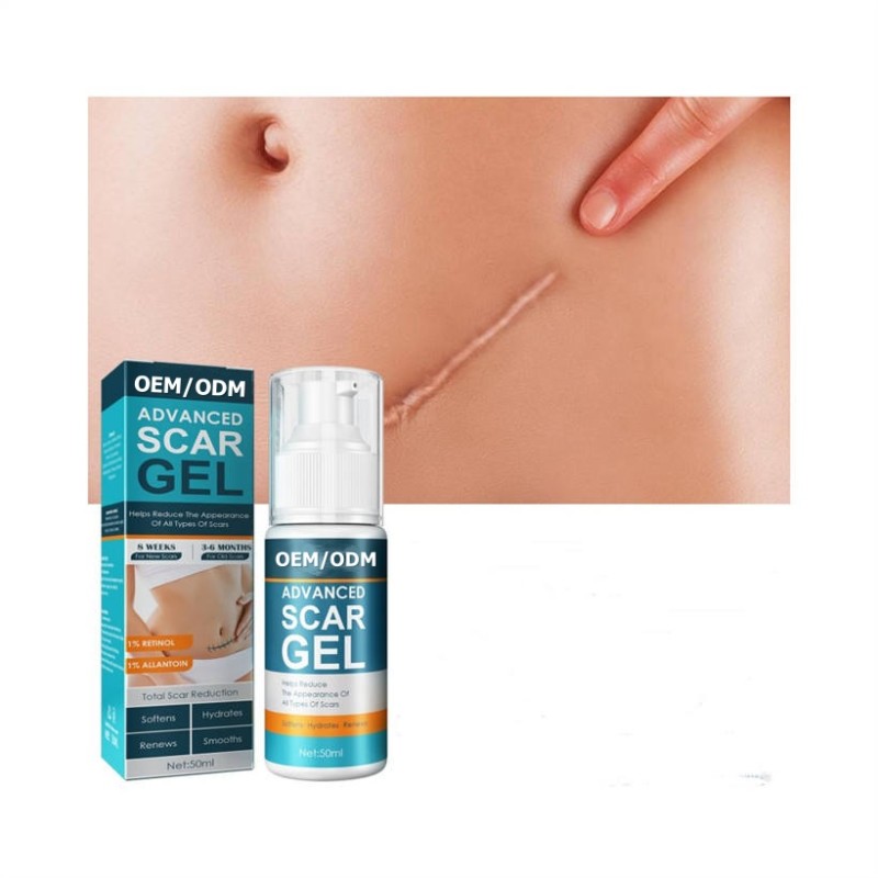 Skin Care Scar Gel Supplier - Private Label Home Use Fade Marks Regeneration Removal