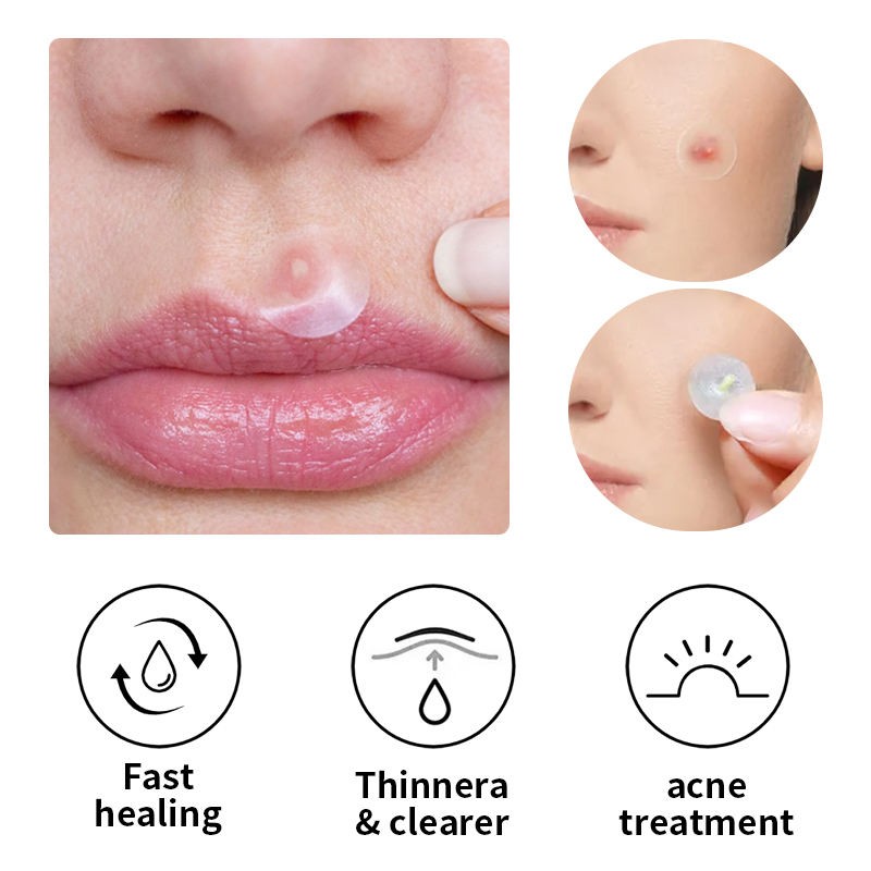 Ultra-Thin Acne Patch Manufacturer - Rapid Pimple Blemish Relief Clear Dots Dermatologist
