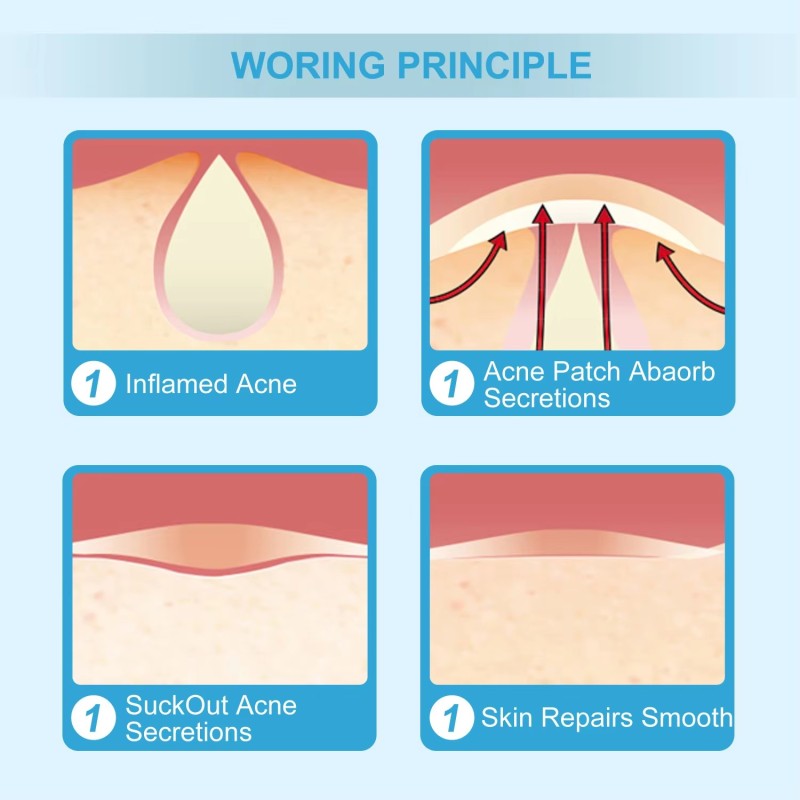 Invisible Pimple Patch Supplier - Customizable Hydrocolloid Acne Support Mouth Nasal