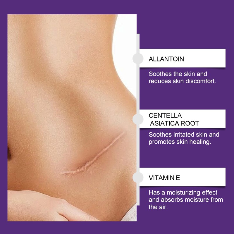 Scar Repair Gel Manufacturer - 2025 New Advanced Treatment Private Label 50g Home