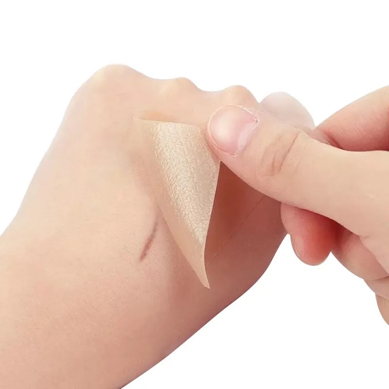 Silicone Scar Sheets Supplier - Hot Selling Professional for Scars Removal Healthcare