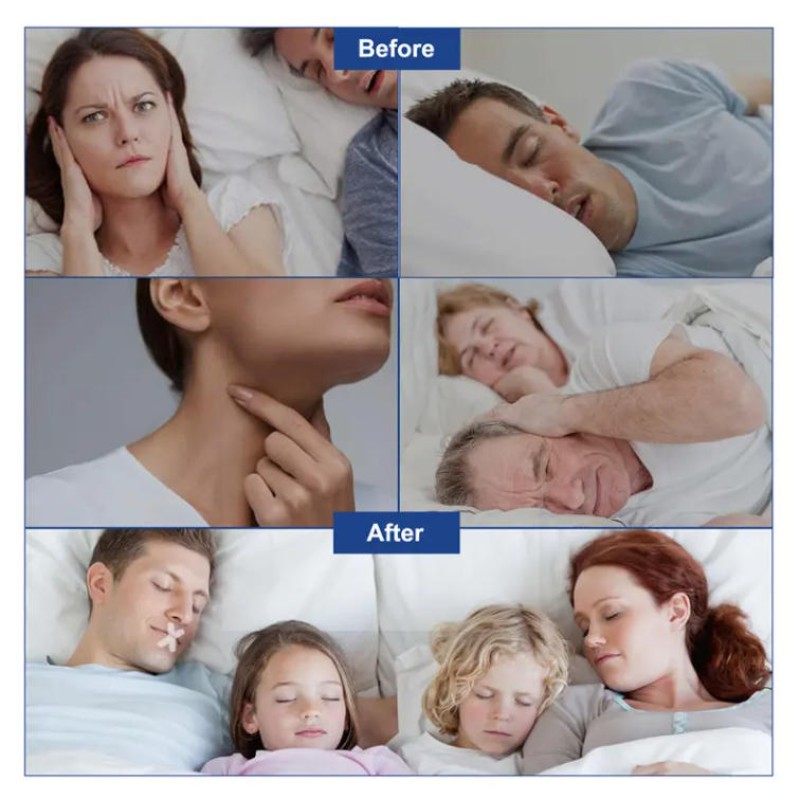 Snore Relief Strips Supplier - China Supplier's OEM ODM Nasal Body Patches Mouth