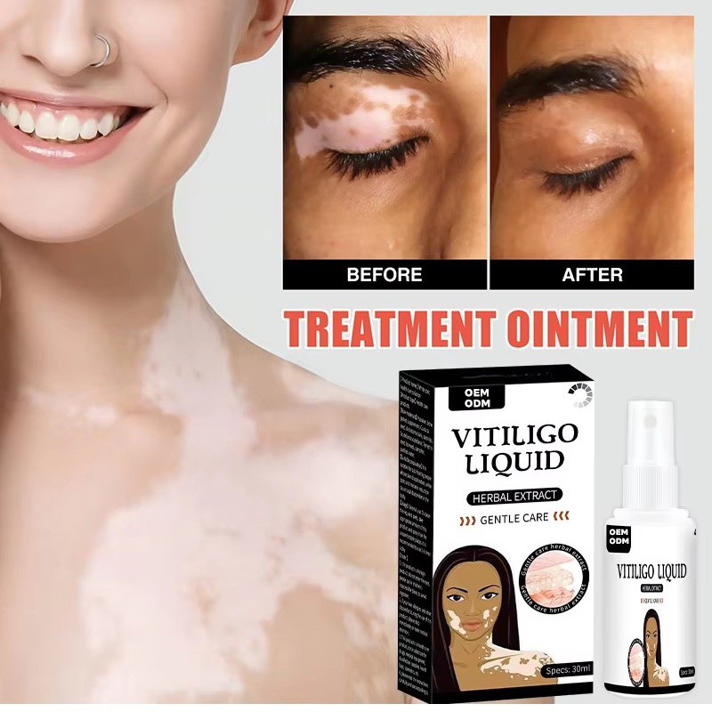 Skin Tone Spray Supplier - Healthcare Supply Liquid Spray for Uneven Tone Vitiligo