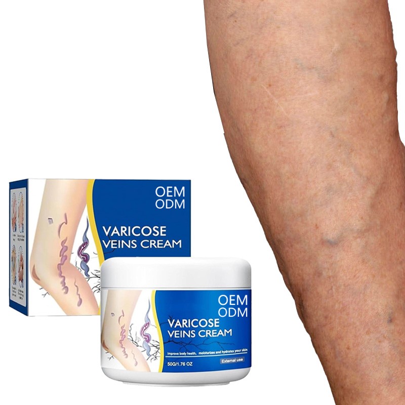 Herbal Cream Supplier - Customized Size Pain Relief Varicose Veins Removal Factory