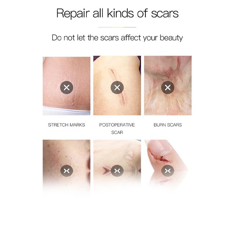 Scar Gel Manufacturer - OEM Customizable Advanced for Old New Scars Healthcare