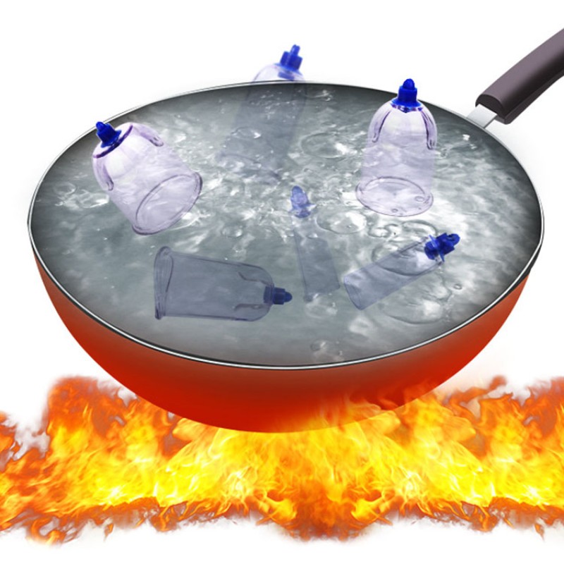 Vacuum Cupping Set Factory - Reusable Hijama Blood Cupping