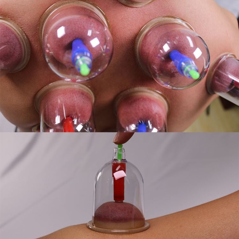 Cupping Therapy Set Manufacturer - Vacuum Suction Hijama Wholesale