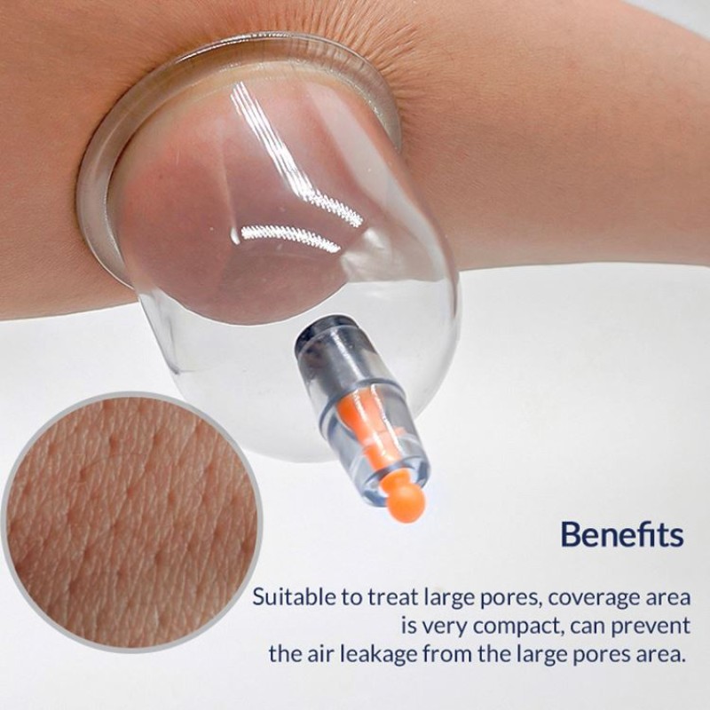 Hijama Cups Supplier - 9 Size 500 Mix Vacuum Therapy