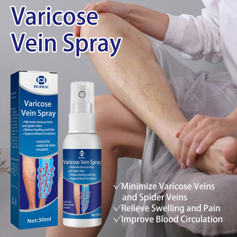 Varicose Veins Spray Supplier - Improve Blood Circulation