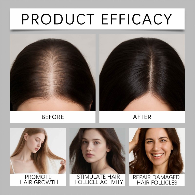 Hair Growth Spray Manufacturer - Rice Water Biotin 50ml