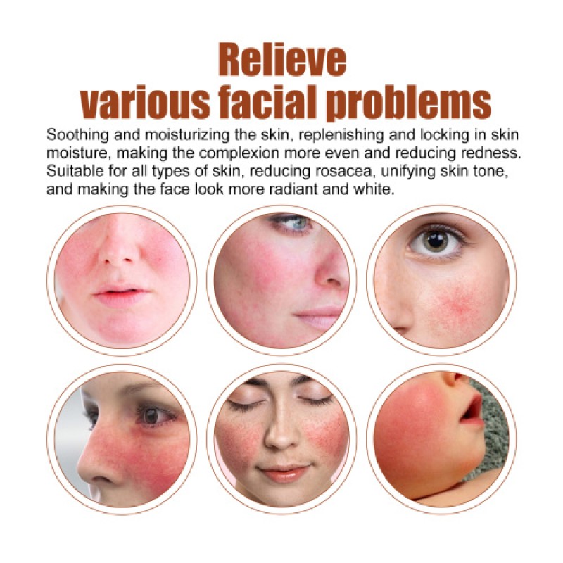 Facial Essence Manufacturer - 30ML Repair Lighten Moisturizing OEM