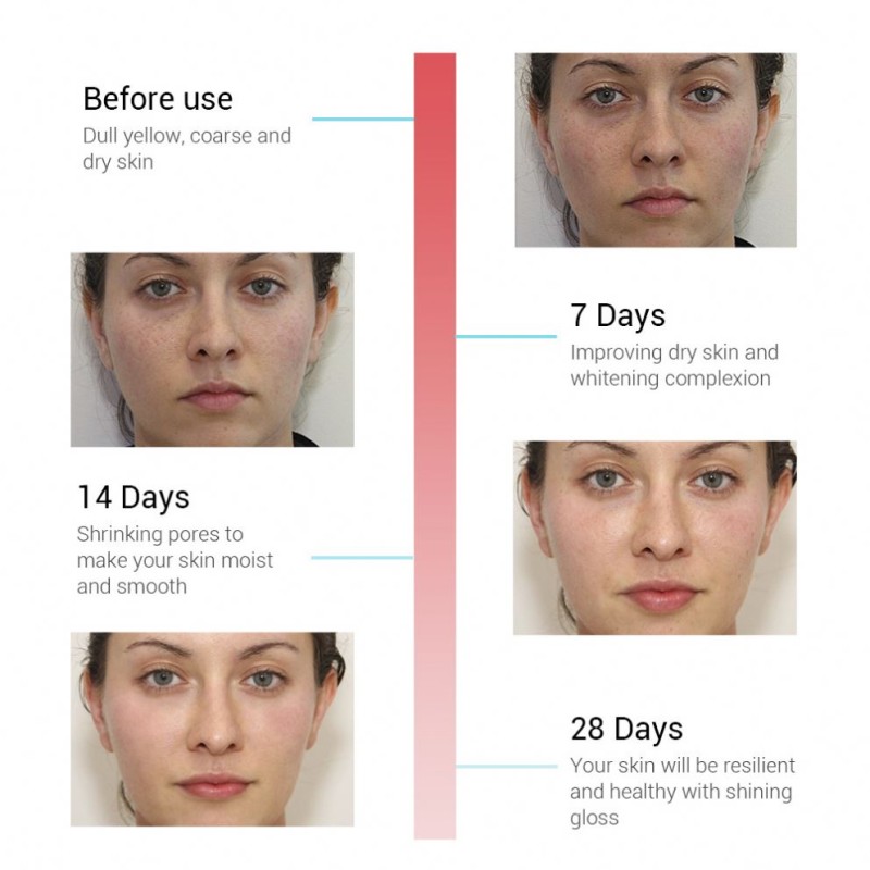 Rose Serum Supplier - Hydrating Natural Extract 17ml