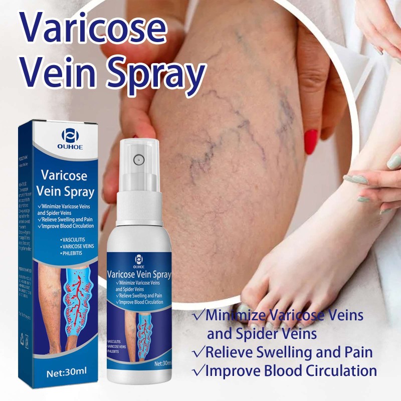 Varicose Veins Spray Supplier - Improve Blood Circulation