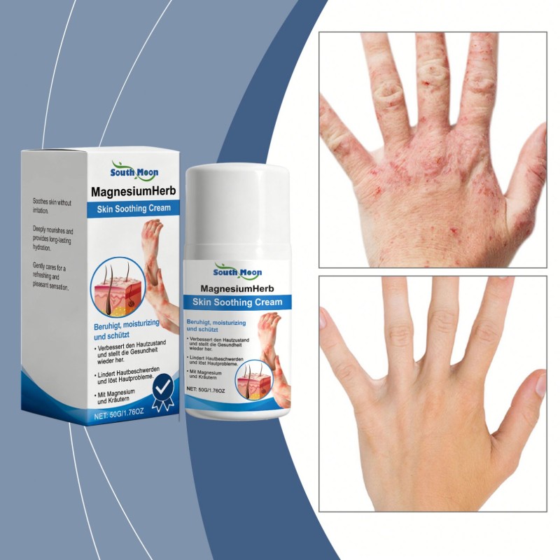 Magnesium Cream Manufacturer - Soothing Redness Itching Care