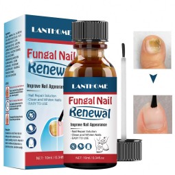 Nail Treatment Oil Factory - Herbal Anti Fungal Renew Formula