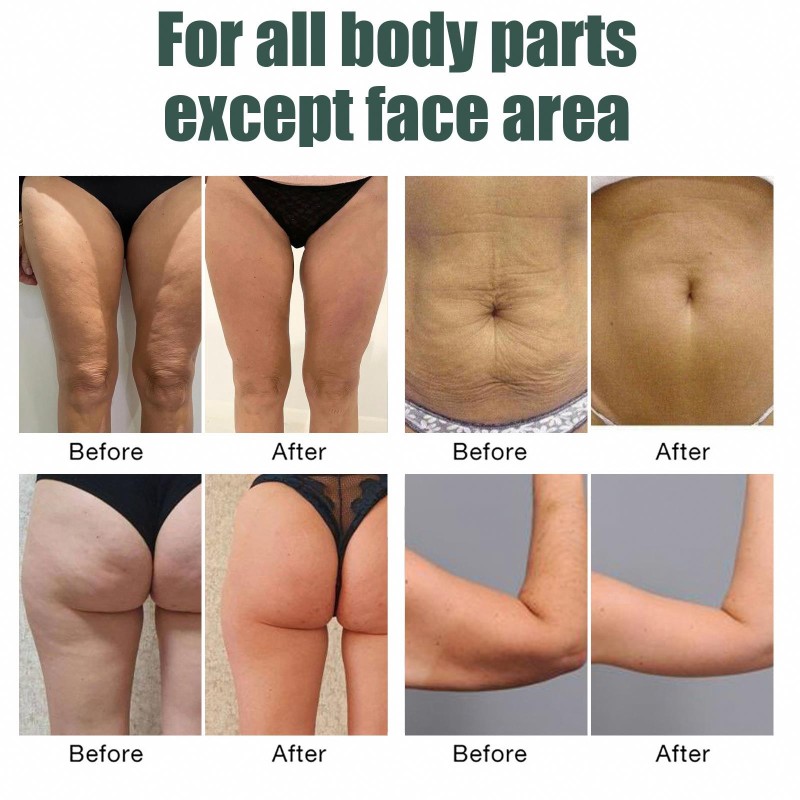 Body Oil Manufacturer - Collagen Lifting Tightening Skin Care