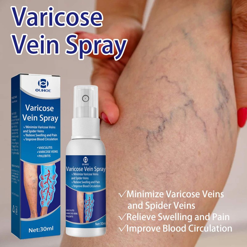 Varicose Veins Spray Supplier - Improve Blood Circulation