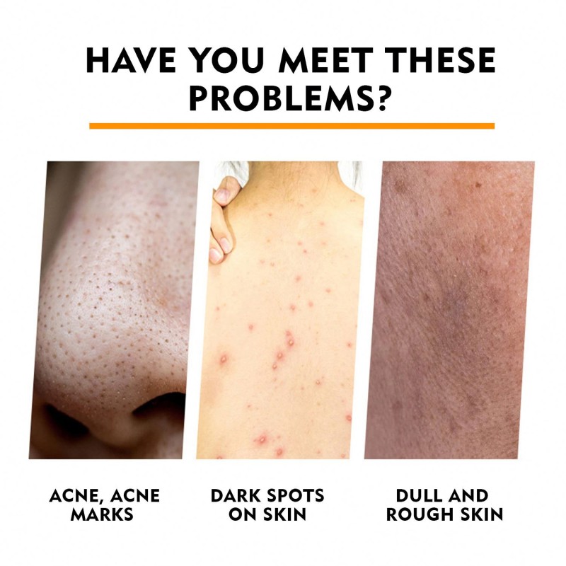 Turmeric Soap Manufacturer - Kojic Acid Skin Brightening Handmade