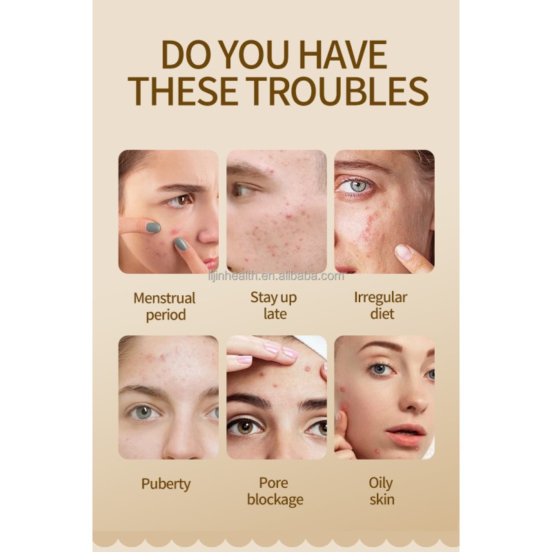 Hydrocolloid Pimple Patch Supplier - New Trending for Covering Zits Mouth