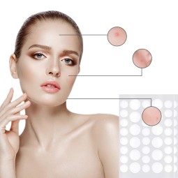 Private Label Acne Patch Manufacturer - Problem-Solving Nasal Body Removal