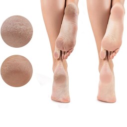 Foot Peel Mask Supplier - Trending Daily Needs Korea Moisturizing Healthcare