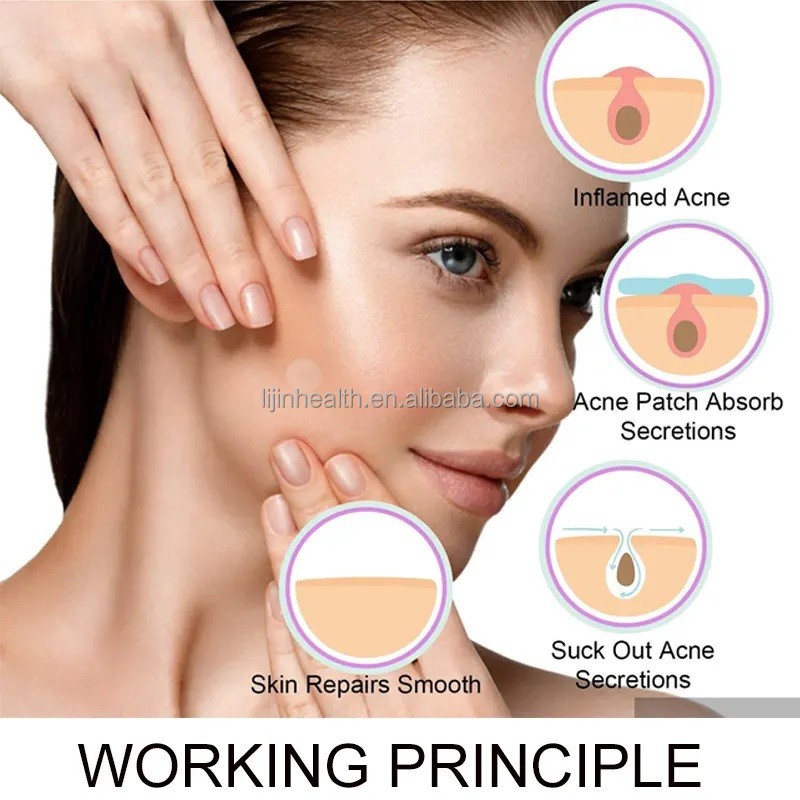 Acne Patch Factory - Trending New Arrivals Hydrocolloid Pimple Scar Sheet
