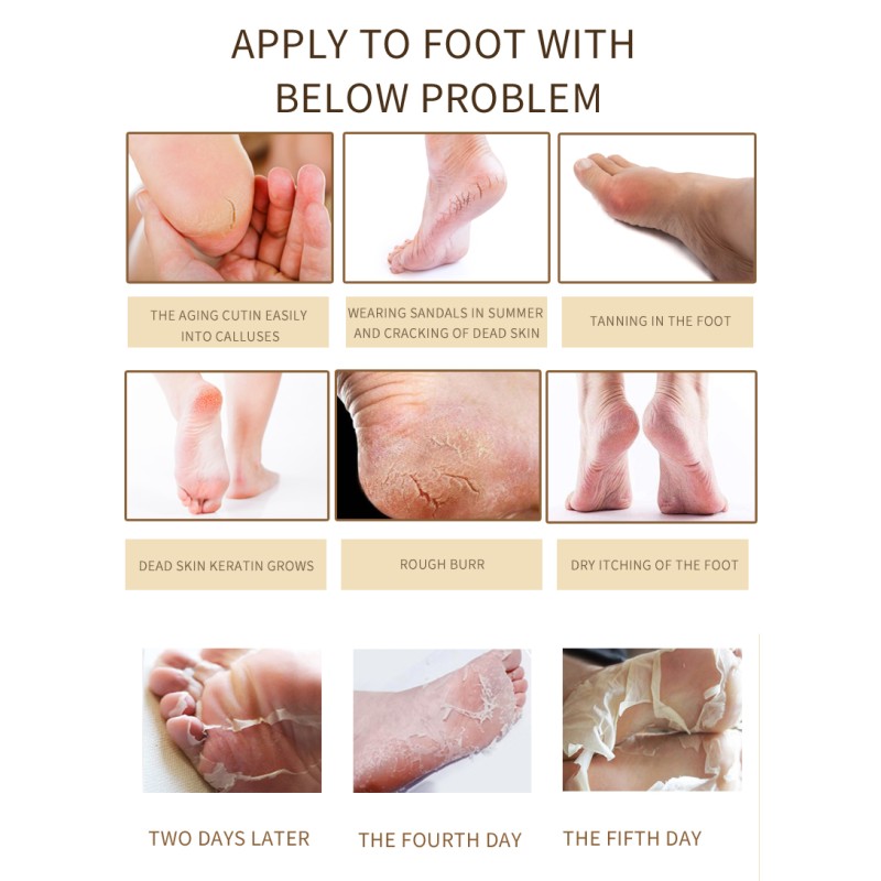 Callus Removal Foot Mask Supplier - Wholesale Moisturizing Pedicure Exfoliating