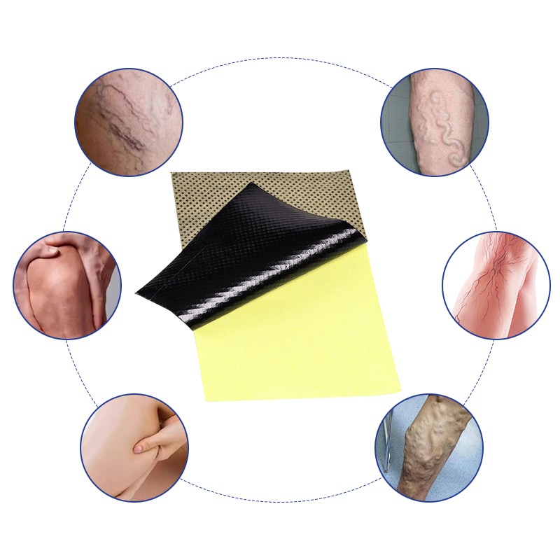 Varicose Veins Patch Supplier - Herbal Supplement Naturally