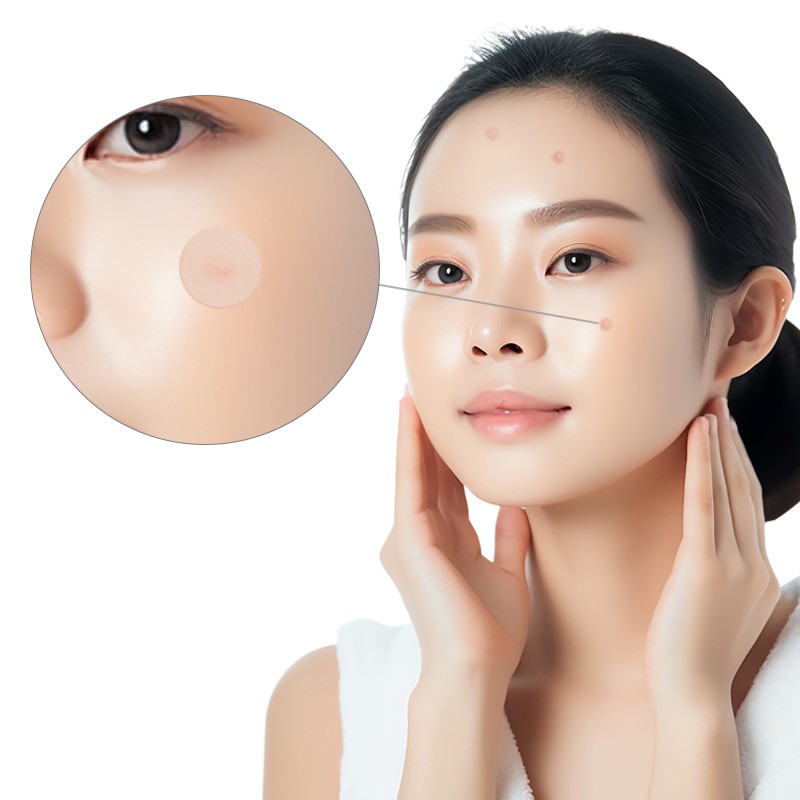 Acne Cover Patch Factory - Facial Stickers Private Label