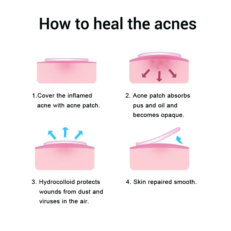 Acne Patch Manufacturer - Healthcare Supply Retain Highlights Skin Care