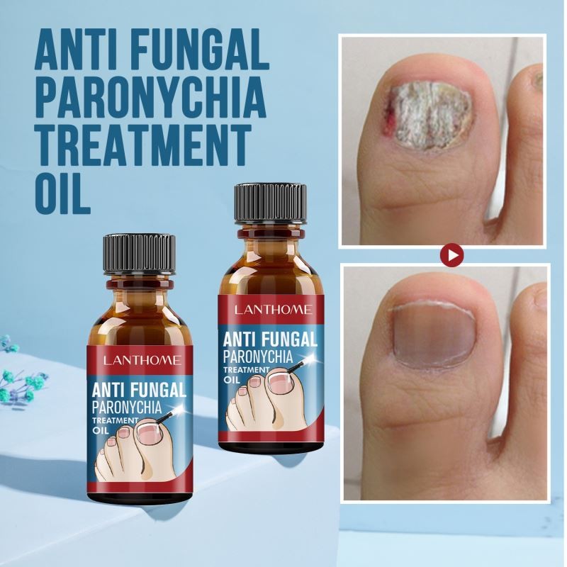 Nail Serum Factory - Natural Foot Hand Toe Fungus Removal