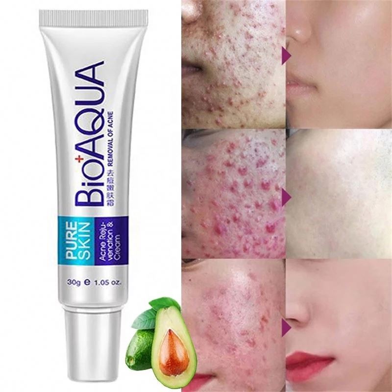 Face Cream Factory - For Bioaqua 30g Anti-Acne Scar Remover