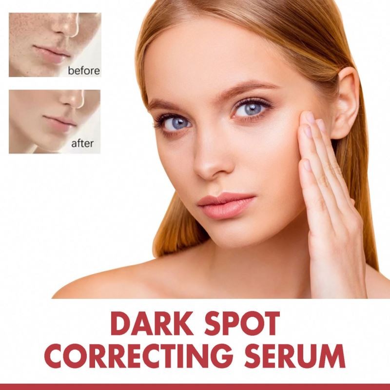 Face Serum Manufacturer - Wholesale OEM Nicotinamide Dark Spot