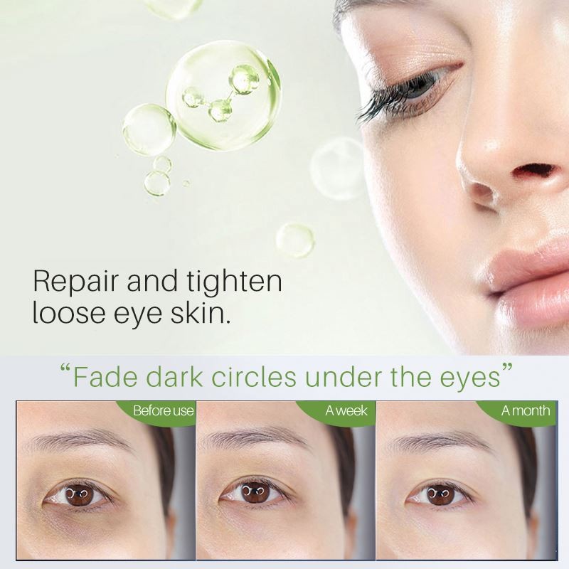 Face Cream Supplier - Lanthome Whitening Oil Acne Scar Removal