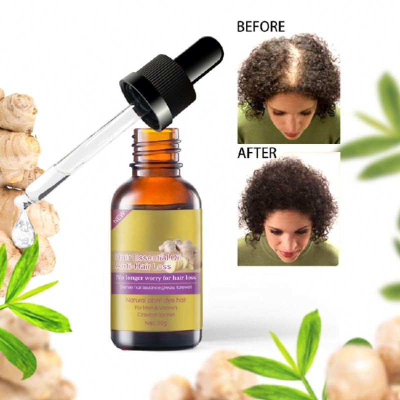 Hair Oil Manufacturer - Anti Loss Ginger Rosemary Vitamin E Care