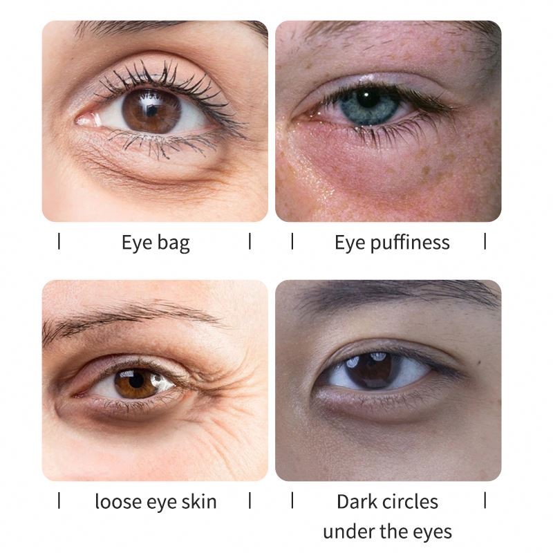 Face Cream Supplier - Lanthome Whitening Oil Acne Scar Removal