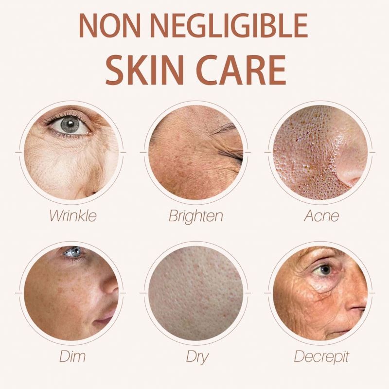 Whitening Cream Manufacturer - OEM Nicotinamide Arbutin Glutathione