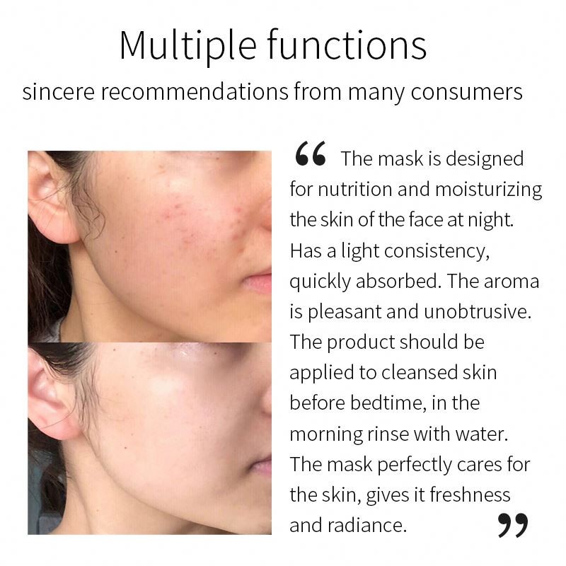 Sleeping Mask Manufacturer - Anti Age Wrinkle Brightening Hydrating