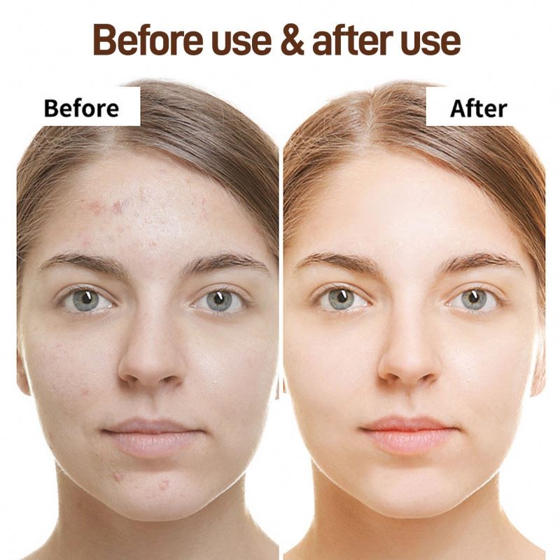 Whitening Cream Manufacturer - Face Whitening Lightening Spots Cream