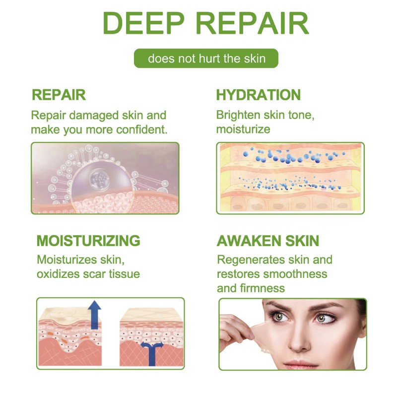 Scar Patch Factory - Hypoallergenic Gel 4cm*3m