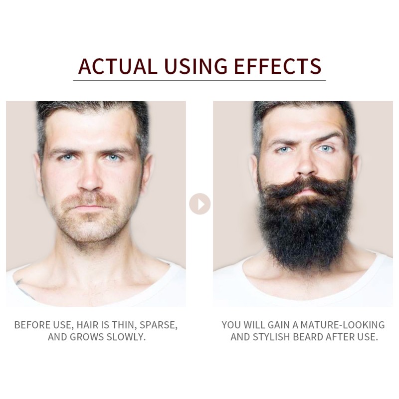 Beard Growth Serum Manufacturer - Anti Hair Loss Thicker Hair Serum