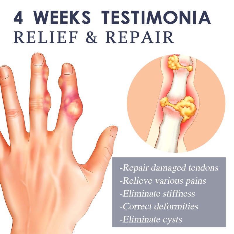 Joint Cream Manufacturer - Bee Venom Pain Relieving Massage Cream