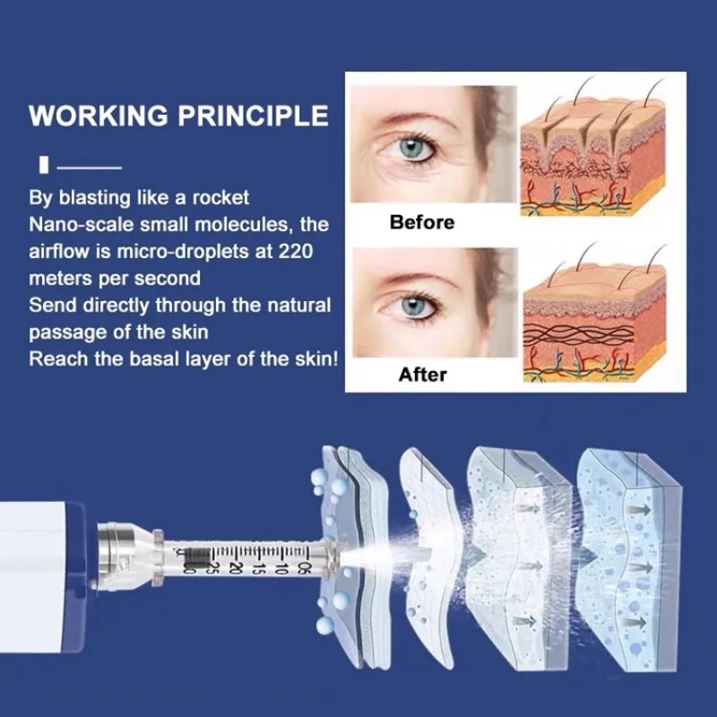Lip Plumper Device Supplier - Electric Hyaluronic Acid Lip Plumper