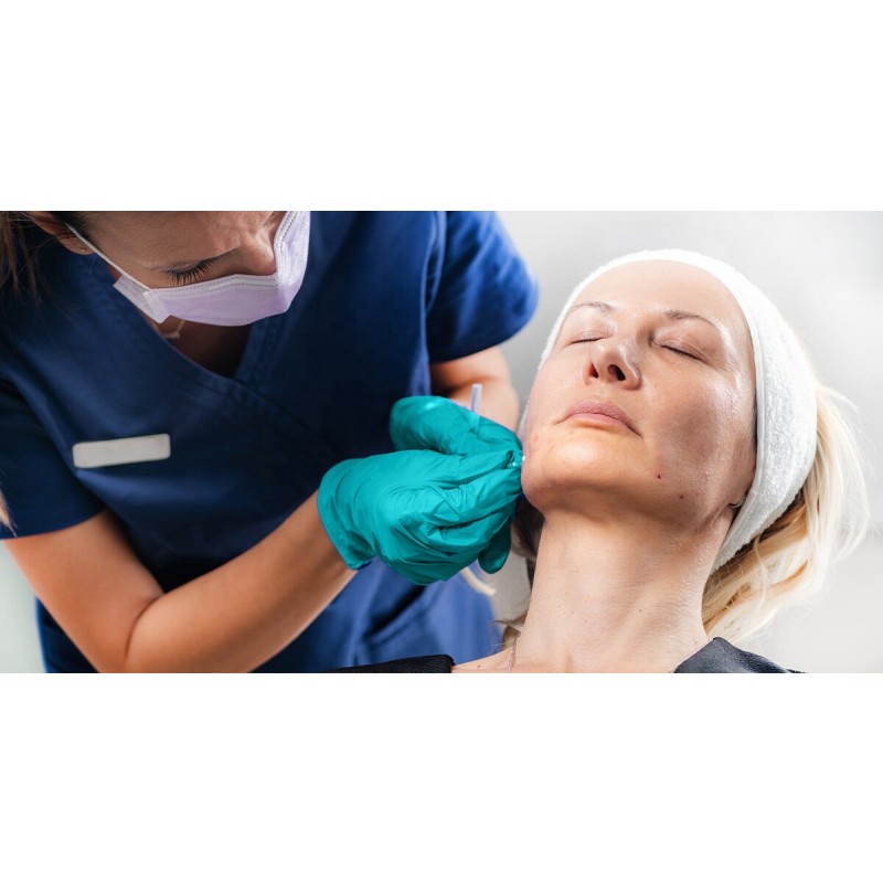 PDO Threads Manufacturer - 4D L Cannula 19G 100MM Facial Threads